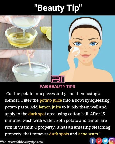 How To Get Rid Of Marks On Face, How To Remove Pimple Marks On Face, Diy Acne Scar Remover, How To Remove Acne Marks, How To Get Rid Of Acne Marks, Acne Marks Remedies, Remedies For Back Acne, Face Cleaning Routine, Remove Acne Marks