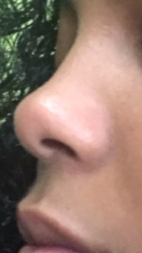 Upturned Nose, Rhinoplasty Nose Jobs, Pretty Nose, Perfect Nose, Small Nose, Nose Surgery, Button Nose, Glo Up, Nose Job