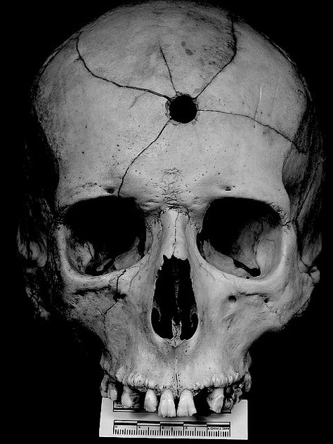 Mouthed off one to many times... Skull Reference, Forensic Anthropology, Gothic Steampunk, Original Characters, Human Skull, A Skull, Skeletal, Skull And Bones, Memento Mori