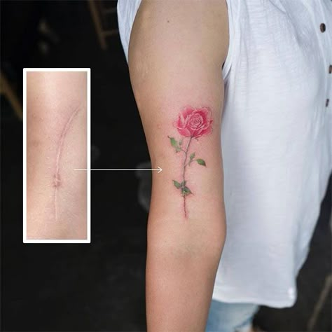 Tattoo Over Scar, Sunflower Tattoo Shoulder, Scar Cover Up, Rose Hand Tattoo, Tattoos To Cover Scars, Scar Tattoo, Tattoo People, Inspiration Tattoos, Chest Tattoos For Women