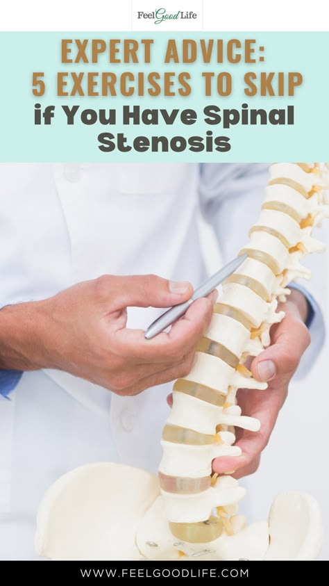 Expert Advice: Learn which 5 exercises to skip if you have spinal stenosis to prevent further discomfort or injury. Gain valuable insights on alternative workouts that promote spinal health and overall well-being, ensuring a safer and more effective fitness journey. #SpinalStenosis #ExercisePrecautions #SpinalHealth #PainRelief #AlternativeWorkouts #SafeFitness #JointHealth #ExpertAdvice Stenosis Of The Spine, Stenosis Exercises, Hip Pain Exercises, Lumbar Lordosis, Sciatic Nerve Pain Relief, Spinal Health, Spinal Fusion, Hip Pain Relief, Muscle Atrophy