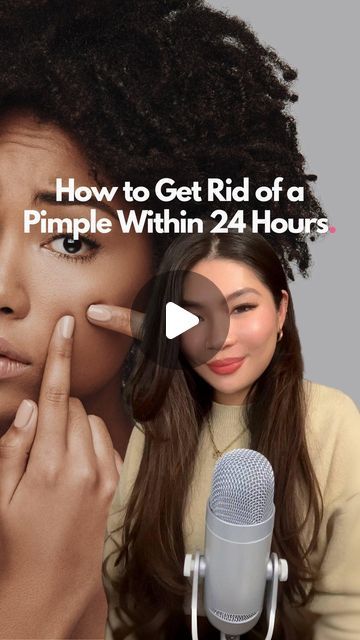 Quick Pimple Remedy, Pimple Remedies Fast, How To Get Rid Of Pimples Fast, How To Get Rid Of Pimples Overnight, Pimple Remedies, Cystic Acne On Chin, Pimples On Forehead, Pimple Scars, Pimples Remedies