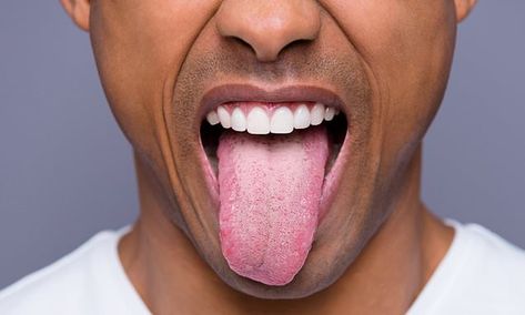 Human Tongue, Kedokteran Gigi, Swollen Tongue, Tongue Scraper, Canker Sore, Viral On Tiktok, Tongue Health, Going Viral, Health Science