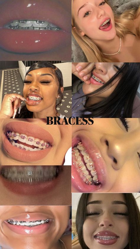 Braces Dental Braces Colors, Cute Braces Colors, Pretty Teeth, Braces Tips, Getting Braces, Cute Braces, Healthy Hair Routine, Diamond Teeth, Brace Face