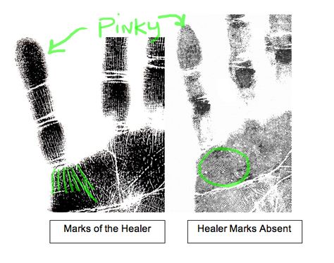 Healer has Vertical Lines under the pinky Wounded Healer Tattoo, Healers Mark Palm, The Healer Has The Bloodiest Hands, Healer Tattoo, Summer Homework, Spirit Healing, Wounded Healer, Theme Board, The Healer