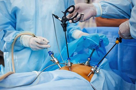 Laparoscopic Surgeon in Pune Big Hospital, Bariatric Surgeries, Prostate Surgery, Workout Model, Bariatric Surgeon, Robotic Surgery, Laparoscopic Surgery, General Surgery, Medical Tourism