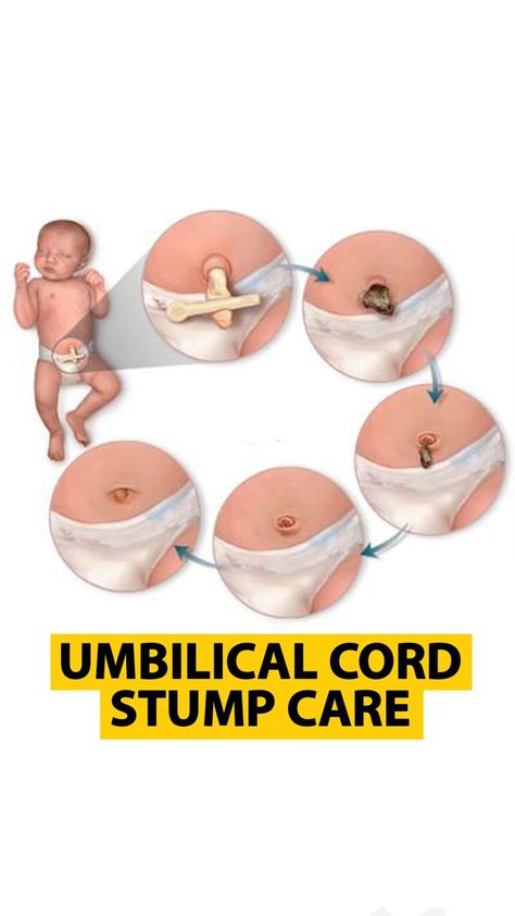 Umbilical cord stump care | Pregnancy Guide | Pregnancy Guide · Original audio Umbilical Cord Care, Baby Umbilical Cord, Umbilical Cord, Pregnancy Guide, Audio, Quick Saves