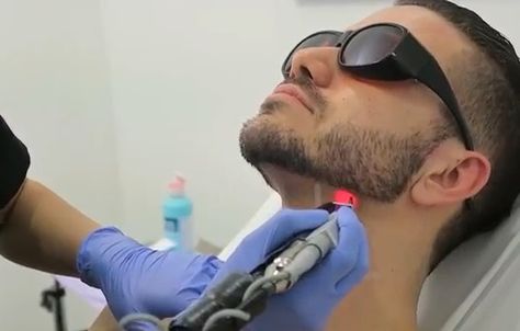 Laser hair removal helps men to keep a clean beard line & to keep skin soft & smooth with very little home care Laser Hair Removal For Men, Laser Hair Removal Men, Laser Hair Removal Face, Beard Line, Clean Beard, Laser Hair Reduction, Fractional Laser, Laser Removal, Hair Removal For Men