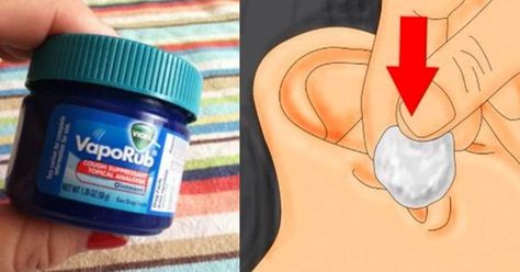 Vic Vaporub, Ear Congestion, Vicks Vapor Rub, Vicks Vapor, Ear Ache, Uses For Vicks, Cough Suppressant, Vapor Rub, Vicks Vaporub