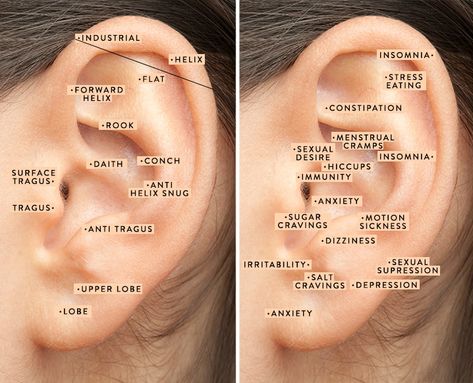 Ear Acupuncture Points Piercing, Ear Piercings To Help Migraines, Ear Piercing Benefit Chart, Piercing Benefits Chart, Piercing That Helps With Headaches, Ear Piercings For Health, Ear Piercings For Headaches, Pressure Point Ear Piercing, Where To Pierce Your Ear