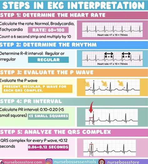 Er Nursing, Emt Study, Medical Biology, Ekg Interpretation, Pr Interval, Ecg Interpretation, Nursing Study Tips, Nursing Information, Med Surg Nursing