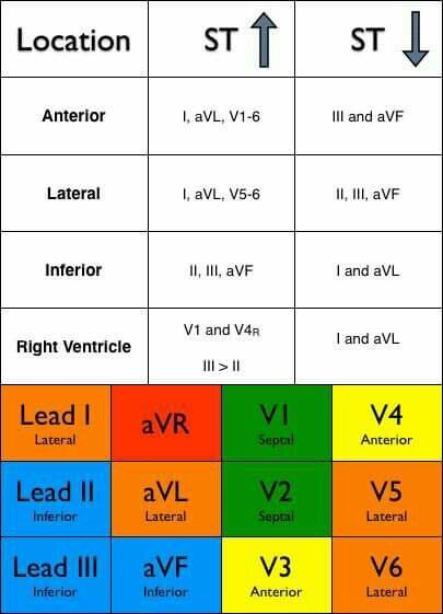 EKG lead interpretation. Cardiology Nursing, Ekg Interpretation, Paramedic School, Nurse Anesthetist, Nursing Mnemonics, Cardiac Nursing, Critical Care Nursing, Medical School Studying, Nursing School Notes