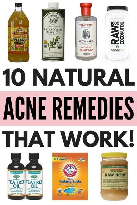 Honey Baking, Coconut Oil For Acne, Skin Care Routine For 20s, Diy Acne, Get Rid Of Acne, Rid Of Acne, Natural Acne Remedies, Natural Acne, Home Remedies For Acne