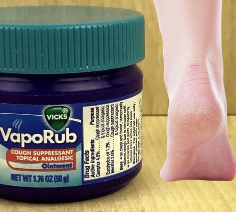 Smooth Feet Remedies, Dry Feet Remedies Overnight, Cracked Feet Remedies, Dry Feet Remedies, Remedies For Cracked Heels, Cracked Heel Remedies, Dry Skin Diy, Diy Foot Soak, Natural Skin Moisturizer