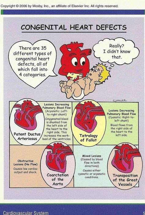 Congenital heart defects Anne Taintor, Ob Nursing, Nursing Mnemonics, Congenital Heart Defect, Neonatal Nurse, Cardiac Nursing, Heart Defect, Nursing School Survival, Congenital Heart