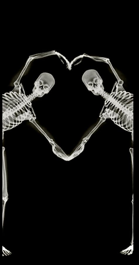 love is for everyone Skeleton Love Wallpaper, Grunge Sharpen, Wallpaper Sharpen, Two Skeletons, Skeleton Wallpaper, Grunge Wallpaper, Skeleton Love, Wallpaper Love, Laughter Quotes