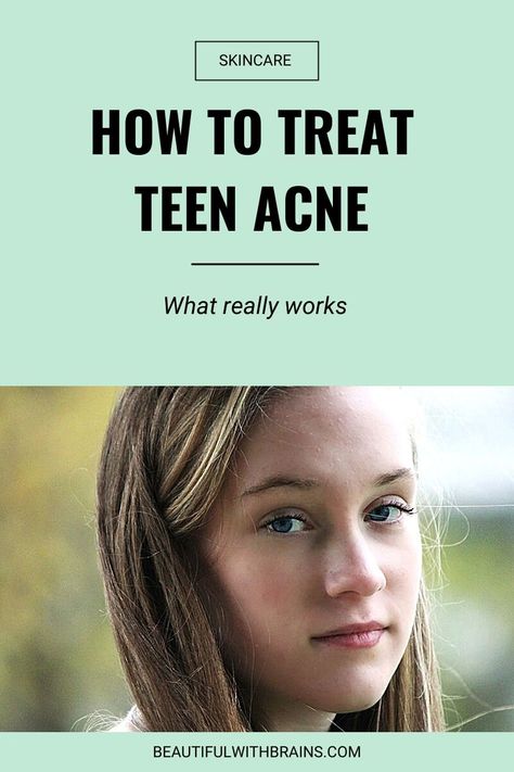 Teenage Acne, Best Skincare Routine, Face Mapping Acne, Forehead Acne, Get Clear Skin, Acne Prone Skin Care, Teen Skincare, Bad Acne, Tips For Oily Skin