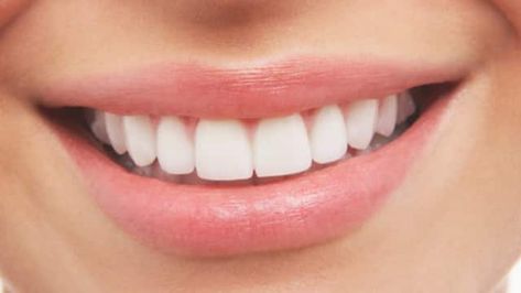 Zoom Teeth Whitening, Sikat Gigi, Beautiful Teeth, Laser Teeth Whitening, Teeth Bleaching, Teeth Whitening Gel, Charcoal Teeth Whitening, Perfect Teeth, Teeth Whitening Strips