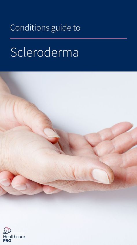 You may be wondering, what is scleroderma? Below, we explore what causes scleroderma, what the symptoms of scleroderma are, and what treatments for scleroderma are available. Remember, you are not alone, and there are many sources of support available to you and your family. Crest Disease, Scleroderma Symptoms, Scleroderma Awareness, Best Lotion, Awareness Quotes, Health Guide, Autoimmune Disease, Tone It Up, Living Well