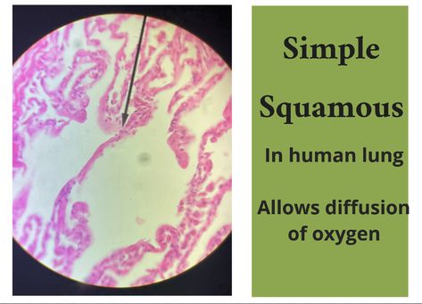 Epithelial Tissue, Human Lungs