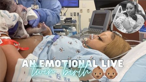 THE LIVE BIRTH OF OUR SECOND SET OF TWINS | *Real, Raw & Emotional* Doctor Turns Breech Baby in Womb Twins In The Womb, Twin Registry, Epidural Birth, Breech Birth, How To Conceive Twins, Baby In Womb, Twins Instagram, Breech Babies, Birth Videos