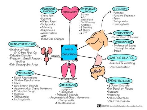 Do you plan on going to PACU when you're out of nursing school? This offers up a great visual on the responsibilities you may face being a PACU nurse.  Follow @nurselinds for more great tips and tools!  Thanks work.chron.com for original post. Pacu Nurse, Perioperative Nursing, Nursing Information, Nursing Cheat, Nursing Fun, Nursing Board, Med Surg Nursing, John Russell, Nursing Mnemonics