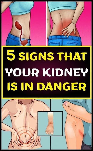 5 Signs That Your Kidney Is In Danger Liver Remedies, Kidney Pain, Diy Herbal Remedies, Tips For Good Health, Health Articles Wellness, Home Remedies For Acne, Kidney Health, Exercise Yoga, Liver Health