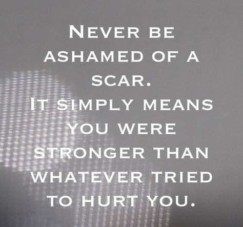 Never be ashamed of a scar! It simply means you were stronger than whatever tried to hurt u! #strongwr Face Quotes, Self Help Books, You Are Strong, Self Help, Health Benefits, It Hurts, Healing, For Free, Quotes