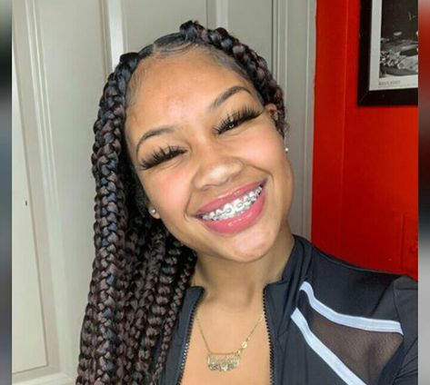 Pretty Black Women With Braces, Braces Aesthetic Girl, Girls With Braces Black, Fine Black Girls With Braces, Braces Color Wheel, Braces Aesthetic Girl Black, Braces Cost, Braces Girls, Straight Teeth