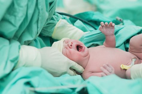 When Circumcised vs. Uncircumcised Becomes Mom vs. Dad Cultural Beliefs, Delivering A Baby, Second Baby, Baby Born, Kids Health, First Baby, Baby Pictures, Pediatrics, How To Look Better