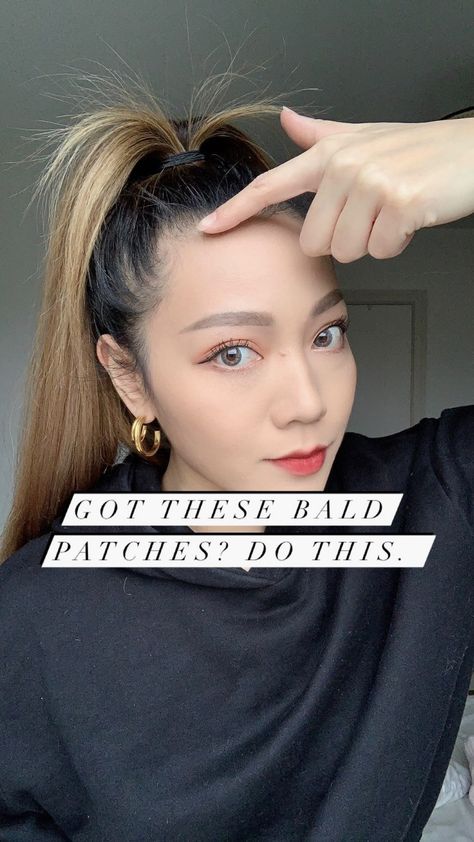 stylesuzi on Instagram: How I do my high ponytail and hide my two hair loss patches. Ever since having a child, these patches come and go. Sometimes they’re more… Hiding Ears Hairstyle, How To Hide Forehead, Hide Forehead Hairstyles, Hide Ears Hairstyle, Hide Widows Peak Women, How To Hide Thinning Front Hair, Hairstyles To Hide Forehead, Ponytail Facelift, Ariana Grande High Ponytail