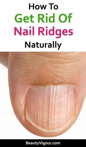 Ridges In Nails, Nail Health Signs, Nail Ridges, Nails November, Nail Growth Tips, 2023 Nail, Nail Problems, November Nails, Fungal Nail