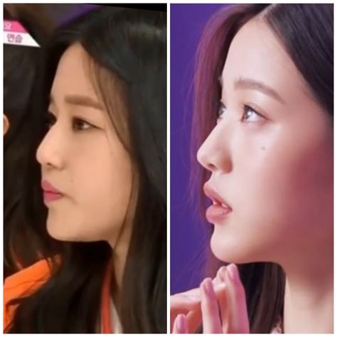 Wonyoung Lips, Eyes Surgery, Nose Surgery, Zero Wallpaper, Eye Surgery, Lip Fillers, Cat Eyes, Night Routine, Red Lips