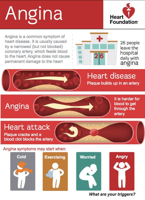 Emt Study, Medical Symptoms, Nursing School Essential, Angina Pectoris, Nursing Student Tips, Nursing School Survival, Nursing School Tips, Medical School Studying, Nursing School Notes