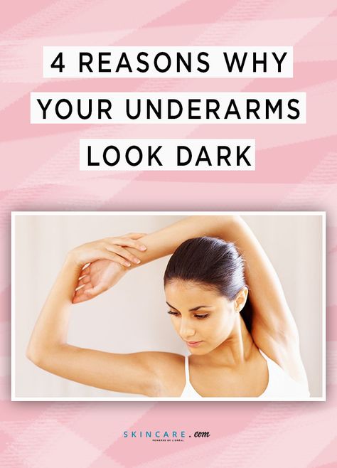 Discoloration in your armpits can be a frustrating skin concern to deal with, but luckily we're here to help. We tapped a board-certified dermatologist to share with us the common causes of dark underarms and how we can combat this skin issue. Discolored Armpits Skin, Dark Skin Under Armpits, Armpit Discoloration, Dark Spots Under Armpits, Armpit Rash, Armpits Smell, Black Armpits, Dark Armpits, Underarm Odor