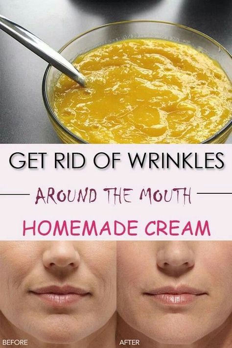 Remove wrinkles on hand efficiently with
these 2 ingredient. You will soon have a soft hands. #howtoremovewrinkles
#howtogetridofhandwrinkles
#everydayhealthcare #handwrinkles
#wrinklesonhand #handswrinkled
#handwrinkleshomeremedy
#removewrinklesfromhand
#getridofhandwrinkles
#homeremedyforwrinkledhands Wrinkles Around Mouth, Mouth Wrinkles, Brown Age Spots, Anti Aging Homemade, Obličejové Masky, Anti Aging Remedies, Homemade Wrinkle Cream, Brown Spots On Skin, Spots On Skin