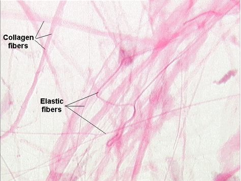 collagenous and elastic fibers Collagen Fibers, Anatomy, Medicine, Google Search, Elastic