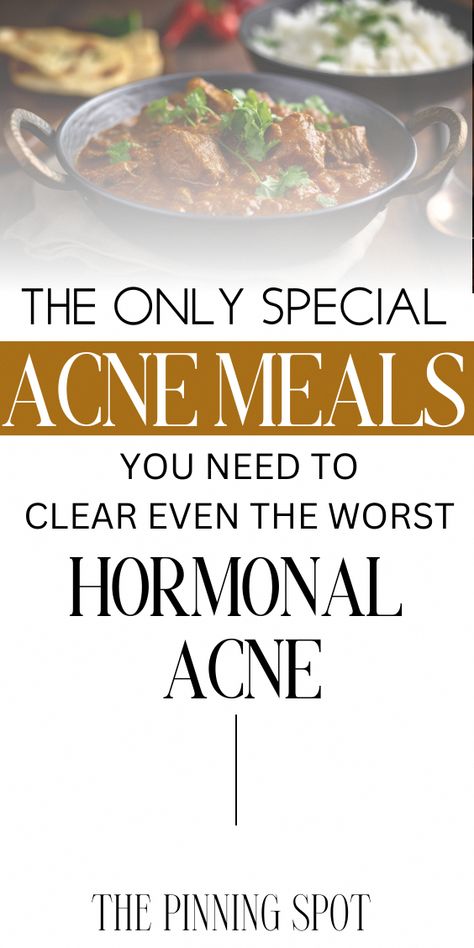 This post will show you which drinks clear your skin, which food to eat to clear acne and give you glowing skin, anti acne drinks, things not to eat or drink if you want to clear acne. Also, I share the healthy & unhealthy eating habits that have either caused my acne or cleared it. Anti Acne Recipes, Acne Diet Plan Hormonal, Acne Drink, Treat Hormonal Acne, Anti Acne Diet, Cheek Acne, Cystic Acne Remedies, Clear Your Skin, Acne Diet