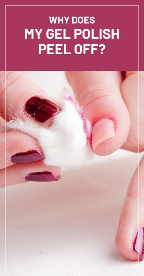 Why Does My Nail Polish Peel Off, How To Keep Gel Nails From Peeling, Peel Off Nail Polish, Nail Polish Spill, Nail Remedies, Peeling Nails, Shellac Nail Polish, Gel Nail Set, Acrylic Nail Polish