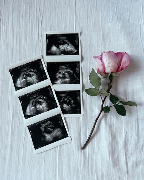 10 Week Ultrasound Pictures, Positive Pregnancy Test Pictures, Second Baby Announcement, Ultrasound Reveal, Baby Ultrasound Pictures, Ultrasound Announcement, Simple Pregnancy Announcement, Pregnancy Announcement Pictures, Pregnancy Announcement Family