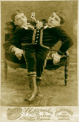 16 Shocking Things About the Tocci Brothers, Famous Conjoined Twins Who Retired at 20 Siamese Twins, Old Circus, Sideshow Freaks, Circus Sideshow, Human Oddities, Conjoined Twins, Two Heads, Vintage Circus, Weird And Wonderful