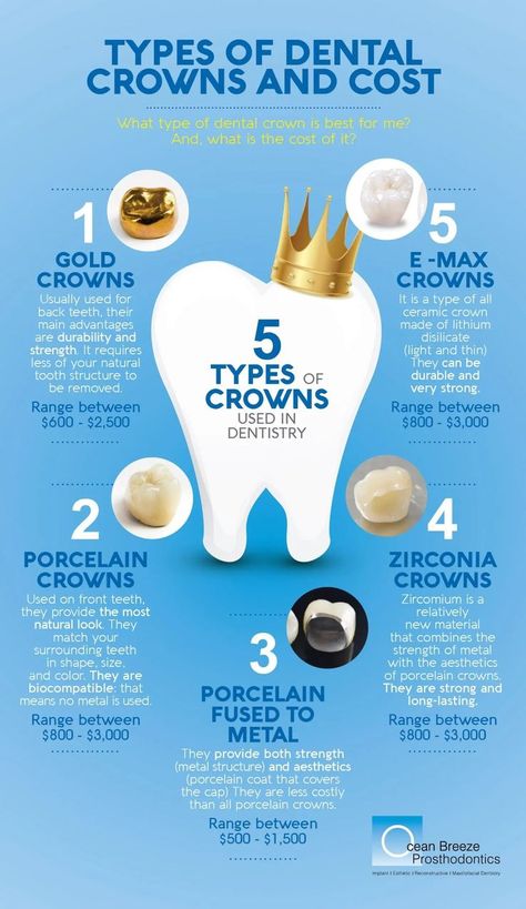 Types Of Crowns, Dental Assistant Study Guide, Dental Assistant School, Dental Hygienist School, Dental Assistant Study, Dentist Assistant, Dental Hygiene Student, Dental Posts, Remedies For Tooth Ache