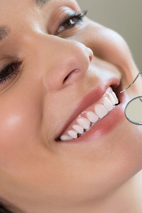 Scaling Teeth, Cosmetic Bonding Teeth, Smile Design Dental Teeth, Dental Endodontic, Teeth Cosmetic Dentistry, Cosmetic Dentistry Before And After, Tooth Infection, Tooth Ache Relief, Registered Dental Hygienist