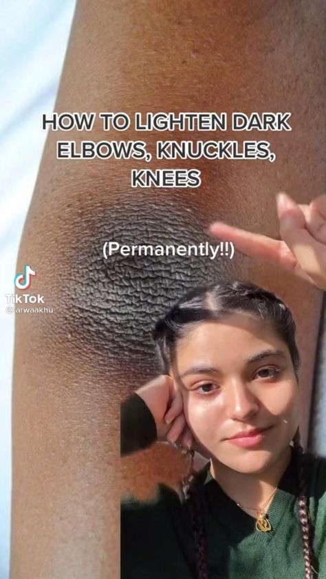 Dark Knees, Beginner Skin Care Routine, Skin Care Basics, Face Skin Care Routine, Skin Care Routine Order, Clear Healthy Skin, Diy Skin Care Routine, Natural Face Skin Care, Serious Skin Care