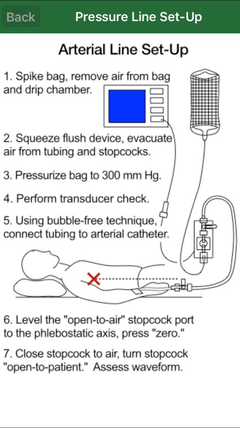 Setting up a CVP/ART line Arterial Line, Pass Nursing School, Line Template, Nursing Mnemonics, Neonatal Nurse, Nursing School Survival, Cardiac Nursing, Critical Care Nursing, Nursing School Studying