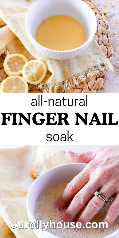 How to Strengthen Nails Naturally at Home? Gel Nail Art Ideas, Natural House Cleaners, Cute Nails Black, Nail Remedies, Nail Growth Tips, Hand Soak, Strengthen Nails, Nail Care Diy, Grow Nails Faster