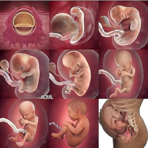 Baby In Womb, Biology Projects, Birth Art, Basic Anatomy And Physiology, Human Body Anatomy, Medical School Essentials, Fashion Terms, Medical Anatomy, Body Anatomy