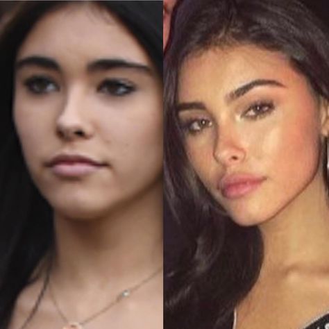 Madison Beer plastic surgery natural vs after work Madison Beer Plastic Surgery, Street Racing Cars, After Surgery, Madison Beer, Plastic Surgery, Surgery, Hair Makeup, Beer, Hair