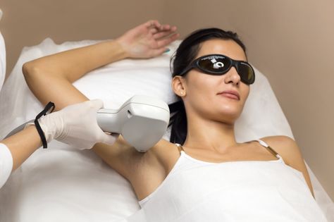 How to get rid of dark underarms #underarms #darkunderarms #darkarmpits Acne Laser, Best Laser Hair Removal, Laser Hair Reduction, Ingrown Hair Removal, Diode Laser Hair Removal, Dark Underarms, Hair Removal Methods, Hair Removal Permanent, Coarse Hair