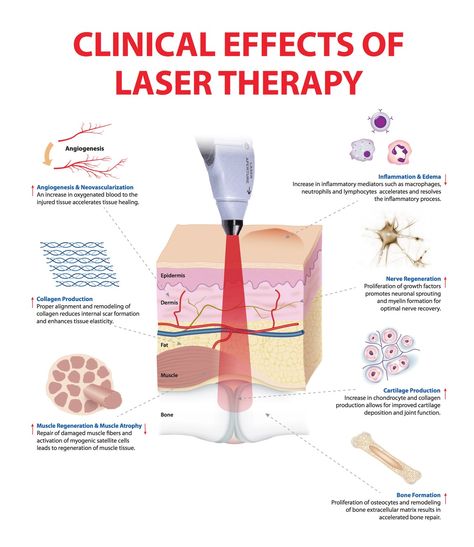 Cold Laser Therapy, Muscle Atrophy, Led Therapy, Decrease Inflammation, Body Therapy, Skin Science, Tension Headache, Laser Therapy, Led Light Therapy